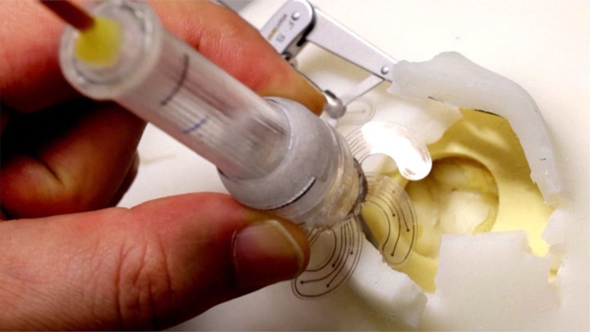 Could Brain Surgery One Day Be Less Invasive? Scientists Think It’s ...