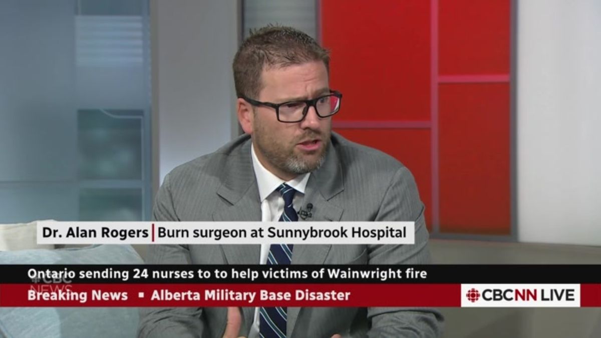 Ontario sends nurses, skin samples to help Wainwright victims ...