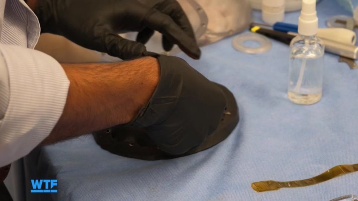 Meet the Removable Brain-Computer Implant | Haystack News