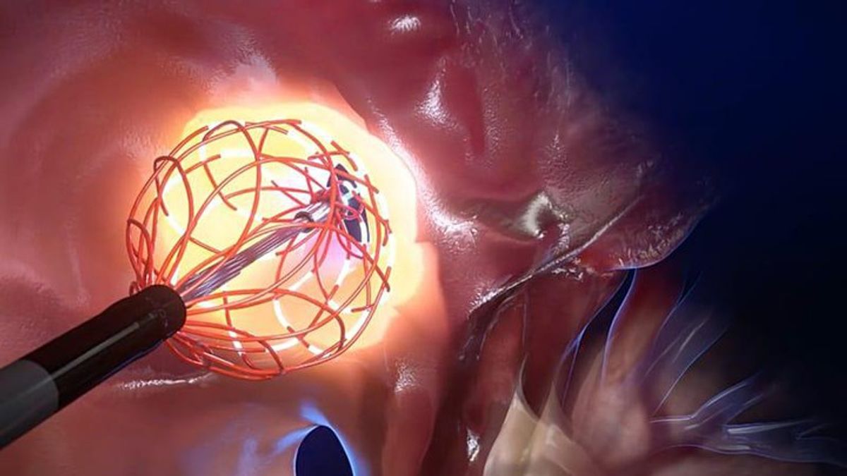 Deep inside the heart: the innovative catheter designed to ...