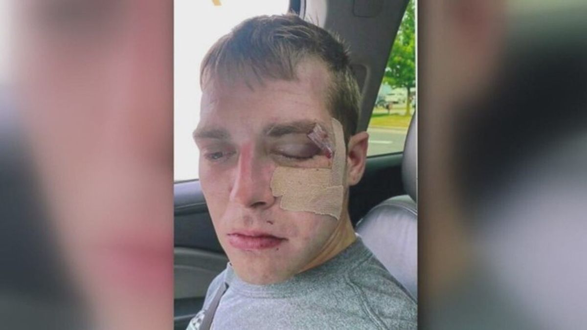 Man awarded $4M in excessive force lawsuit | Haystack News
