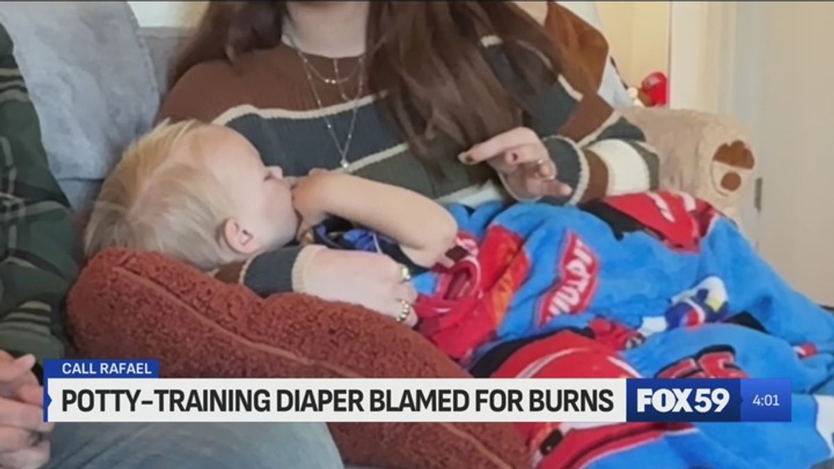 Call Rafael: Indiana 2-year-old in burn unit after using diaper ...