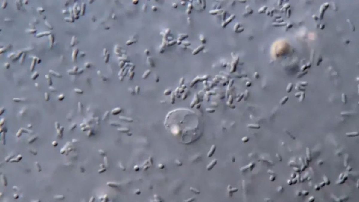 Dallas County investigating possible E. coli cases involving children ...