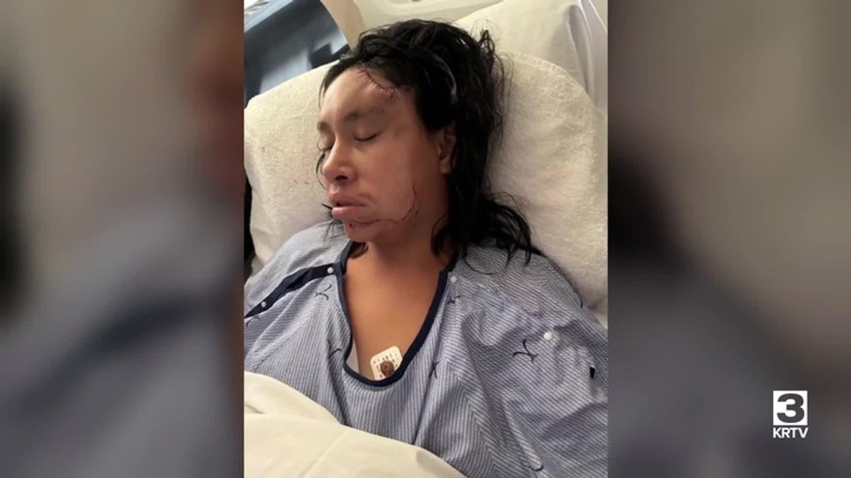 Dogs attack pregnant woman in Lame Deer | Haystack News