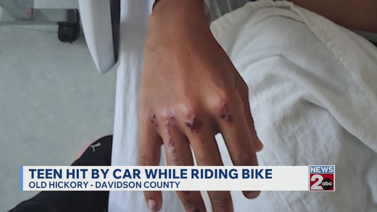Teen hit by car while riding bike in Old Hickory | Haystack News