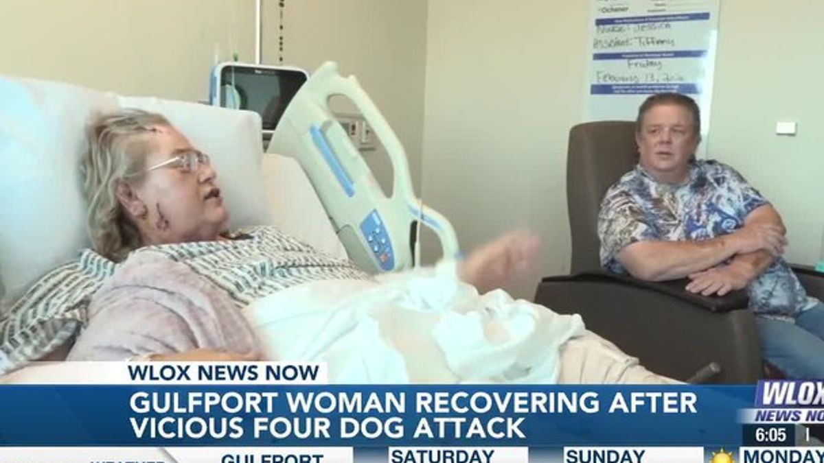 Gulfport woman recovering after vicious four dog attack | Haystack News