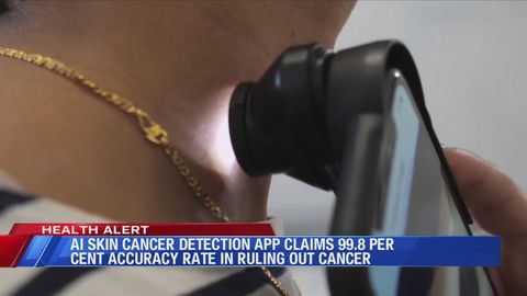 AI skin cancer detection app 99.8% accuracy rate | Haystack News